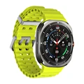 Silver-fluor yellow