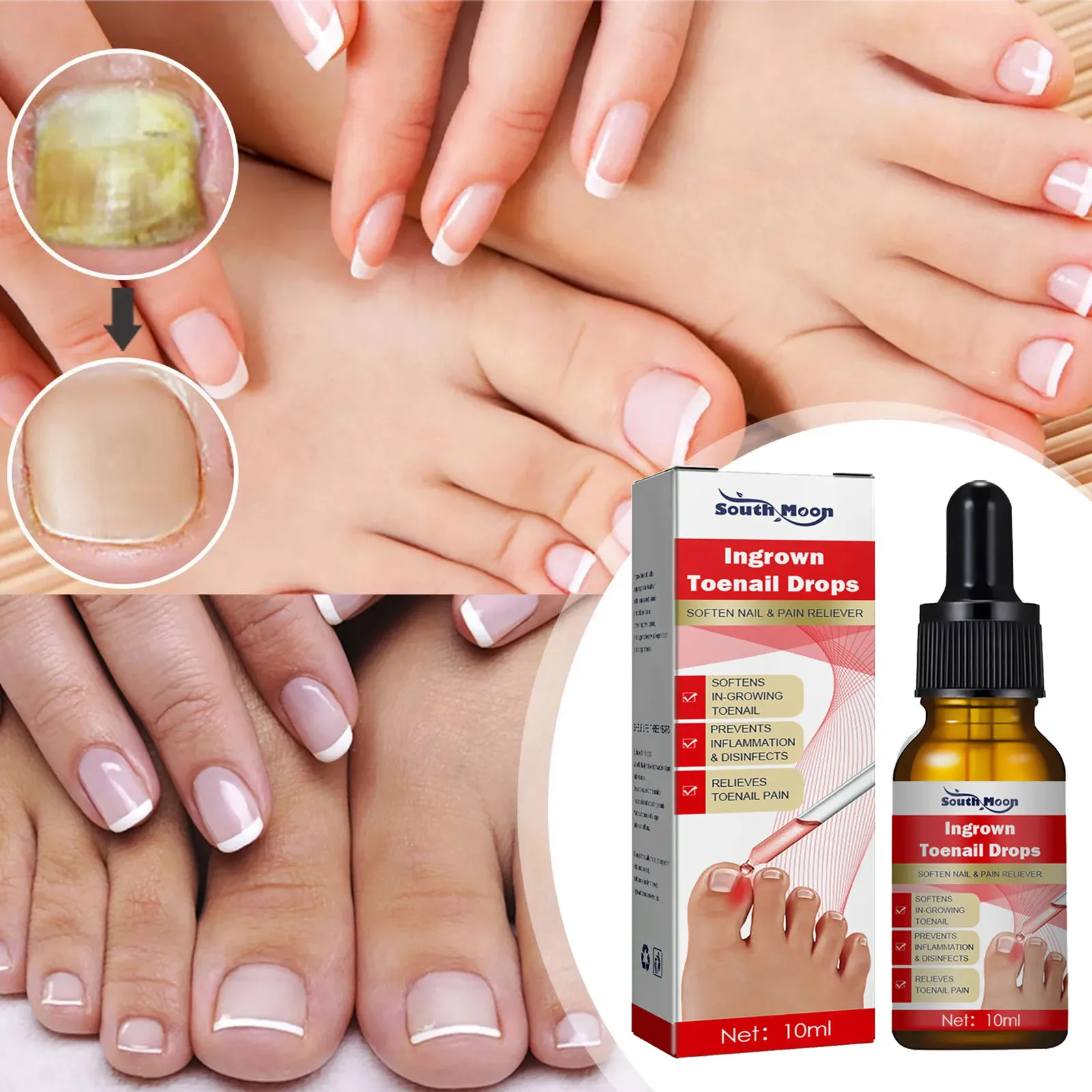 Nail Care Oil Nail Fungus Treatment Nail Strengthener Nail Care Kit 10ml Solution for Foot Toenail