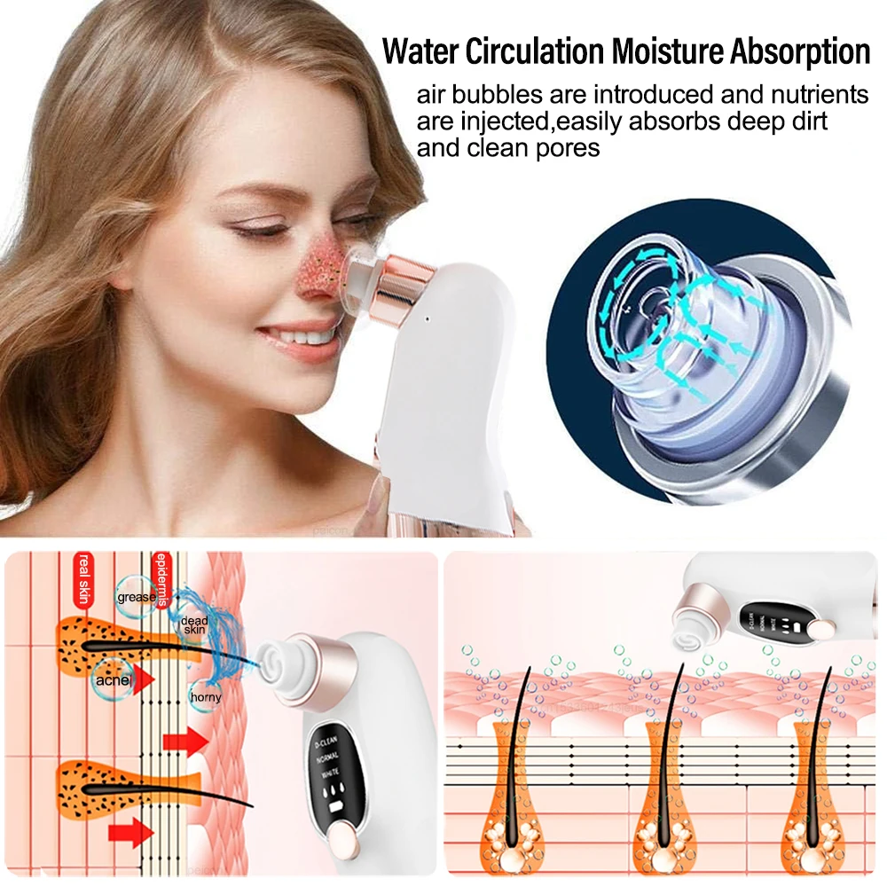 Electric Vacuum Blackhead Remover Bubble Water Cycle Face Dead Skin Acne Pore Cleansing Suction Blackheads Removal Instrument 4