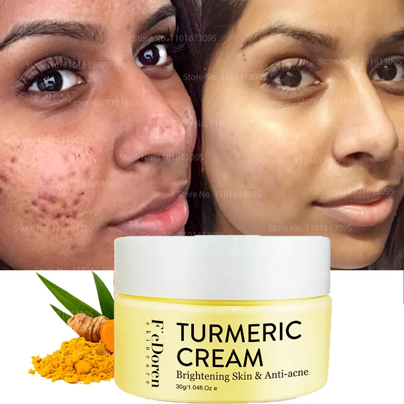 

Turmeric Skin Care Face Cream Natural Organic Moisturizing Whitening Face Cream Repair Acne Lightening Cosmetics for Face