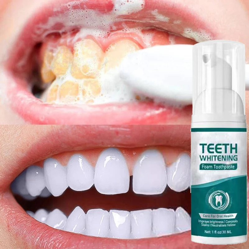 Teeth Whitening Mousse 30ml Dental Care Remove Plaque Stain