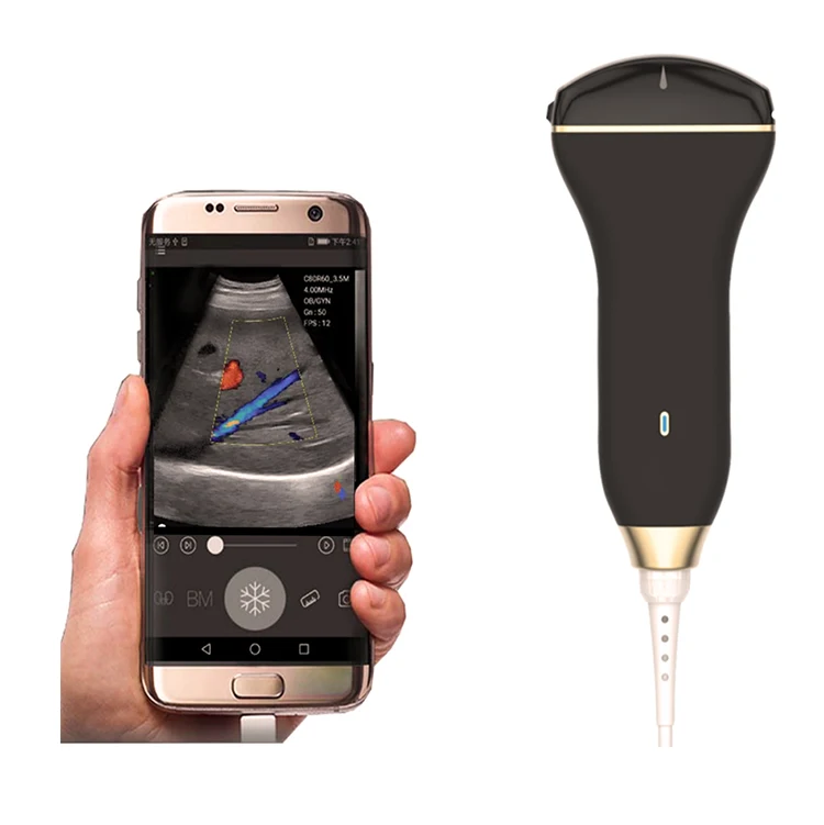 

Mobile USB ultrasound probe price
