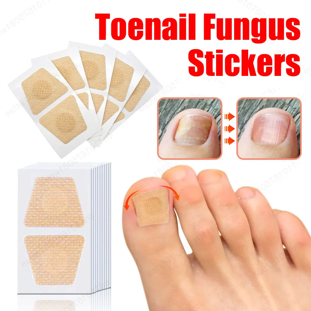 Toenail Fungus Treatment Patches Ingrown Correction Waterproof Sticky Nail Repair Sticker Discolored Damaged Fungal Nails