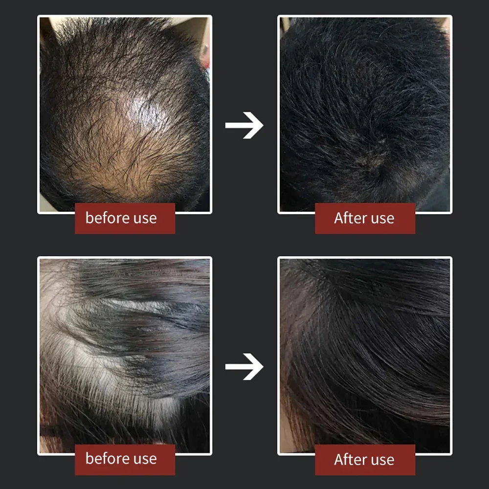 27.5g Authentic Keratin Fiber Hair Building Fibers Natural Fibre Powder Men Grow Spray Thickening Growth Products Hair Care hair building powder,hair building fibers