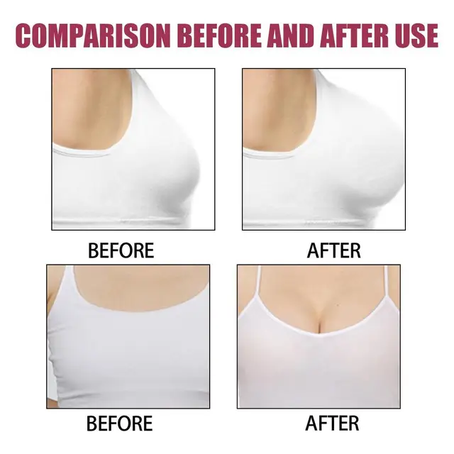 Push up Bust Breast Enhancement Patch - China Breast Paste, Breast  Diseasepain Relief