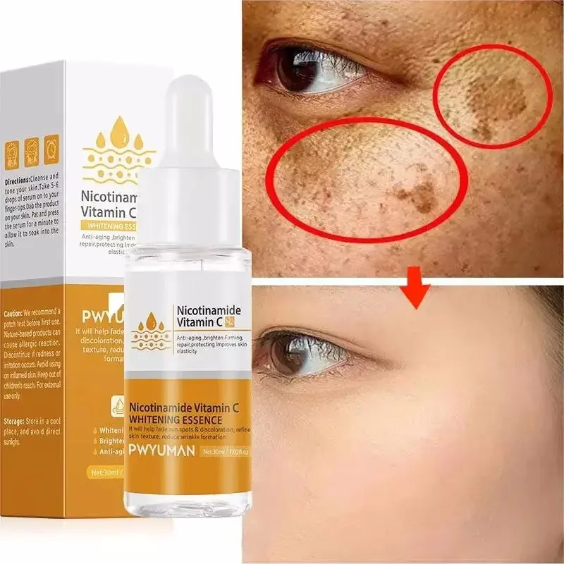 Dark Spots Remover Whitening Face Set Freckle Melanin Correcting Reduce Fine Lines Brighten Essence Korean Beauty Skin Care