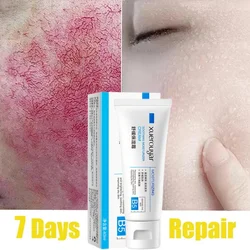 Higher Quality Repair Facial Redness Cream Soothing Skin Rosacea Red Blood Improve Sensitive Skin Acne Moisturizer Cosmetic