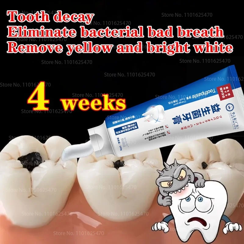 Quick Repair Of Cavities, Caries, Filling, Removal Of Plaque, Stains