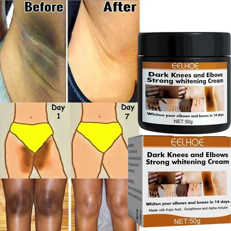 Body Whitening Cream Private Parts Underarm Bleaching Serum Whiten Butt Knee Brighten Inner Thigh Intimate Dark Remove Melanin Body Whitening Cream Private Parts Underarm Bleaching Serum Whiten Butt Knee Brighten Inner Thigh Intimate Dark Remove Melanin