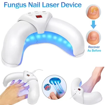 KTS Fungal Nail Laser Device Repair Fast Nails Fungus Onychomycosis Repair Toenail Fingernail Removes Nail Fungus Foot Care 1