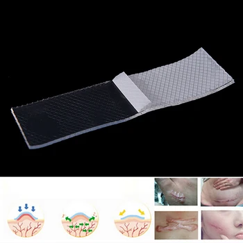 효율적인 수술 흉터 제거 실리콘 젤 시트 치료 패치, 여드름 외상 화상 흉터 피부 복구, 흉터 치료, 3x12cm