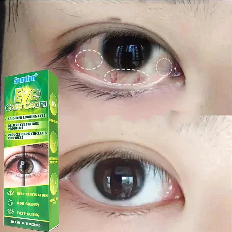 

Eye Care Cream Brighter Looking Eyes Relieve Eye Fatigue Problems Reduces Dark Circles Puffiness Eye Cream 2024 New ﻿
