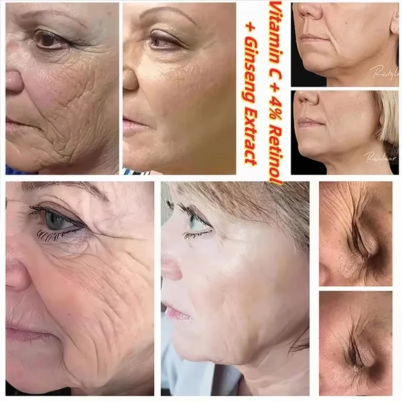 الكورية 1988 ريتينول مصل العناية بالوجه الجينسنغ ا...