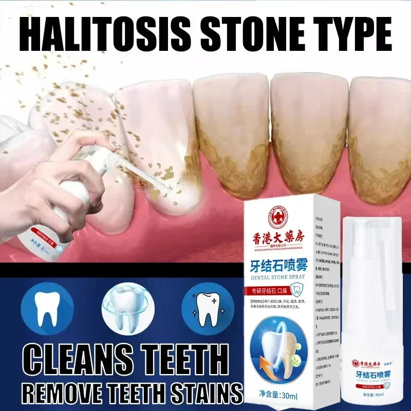 Dental Calculus Remover Teeth Whitening Spray Toothpaste Cleaning Oral Hygiene Removal Halitosis Plaque Stains Fresh Breath Care teeth whitening product,dental calculus remover,teeth health product