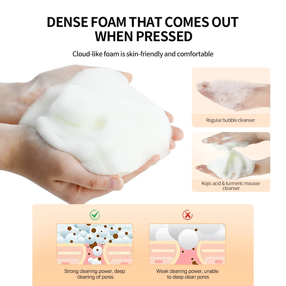 Kojic Acid Turmeric Mousse Cleanser Deep Cleans Pores Reduce Acne Hydrating and Moisturizing Reduce Clogging Doesn't Tighten 6