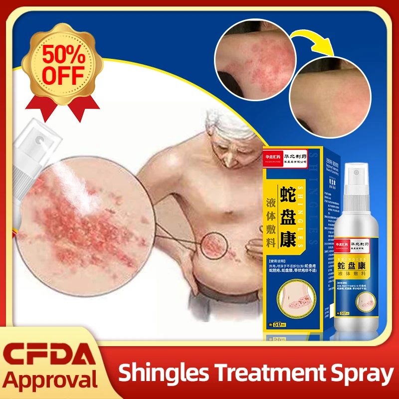 Shingles Treatment Spray Herpes Simplex Cure Cream Apply To Snake Disc Sore Anti-Itching Redness Herpes Zoster Medicine 50Ml