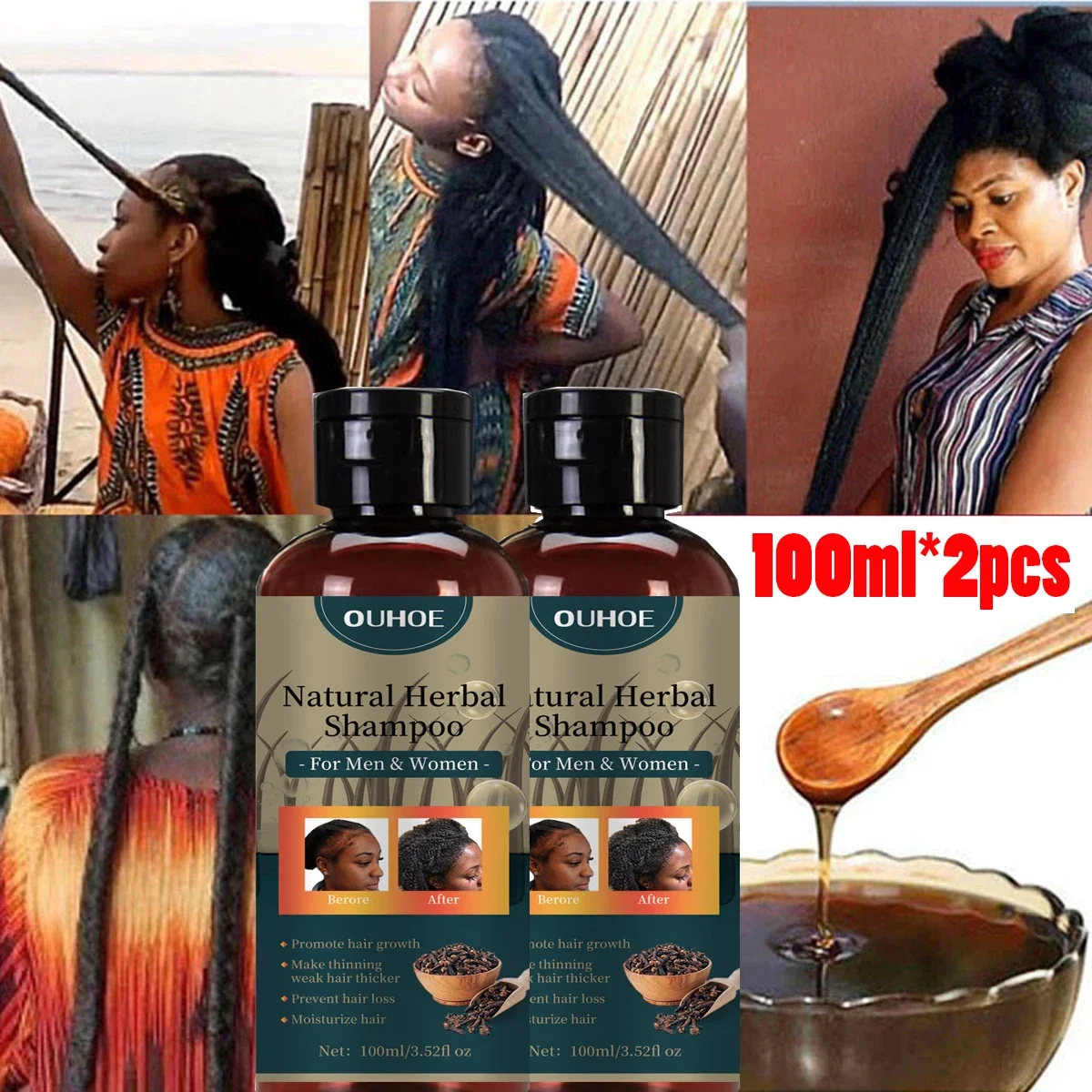 100ml*2 Powerful Effect Fast Hair Loss Treatment Hair Growth Shampoo Ancient African Hair Growth Formula Extract