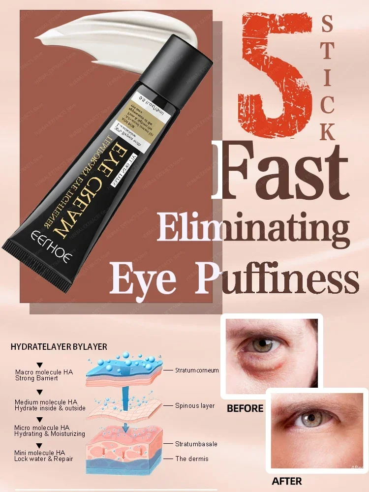 

Eye Cream Dark Circles Remove Bags Puffiness Away Work Under Eyes