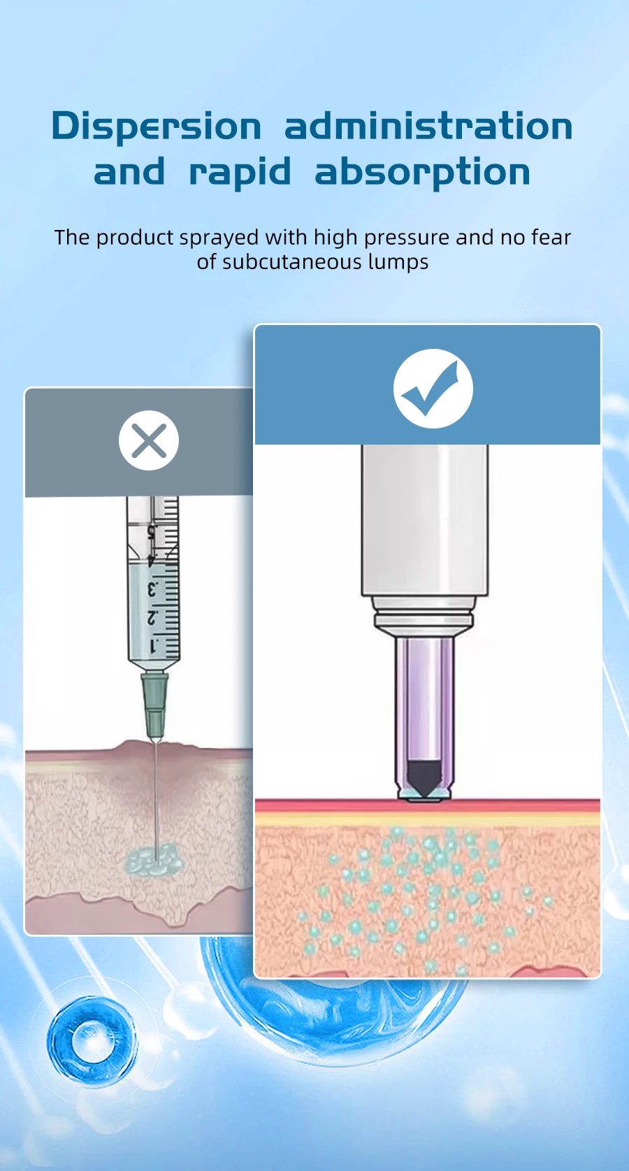Injecteur d'insuline indolore : soin du diabète facile et doux, la nouvelle seringue réglable sans aiguille, réduit la glycémie Saa41605d3c084e7ba2425d3f66f9693dp