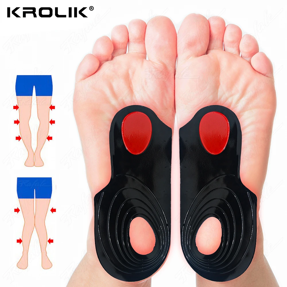 FlatFootOxLegsCorrectionInsolesOrthopedicInsolesArchSupport