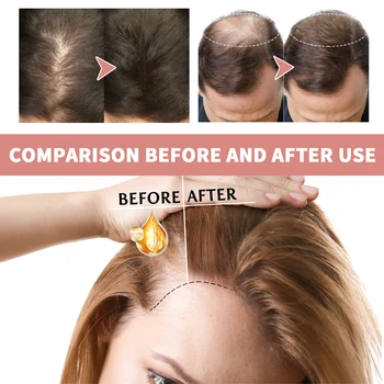 Nourishing Hair Growth Repair Ampoules 3
