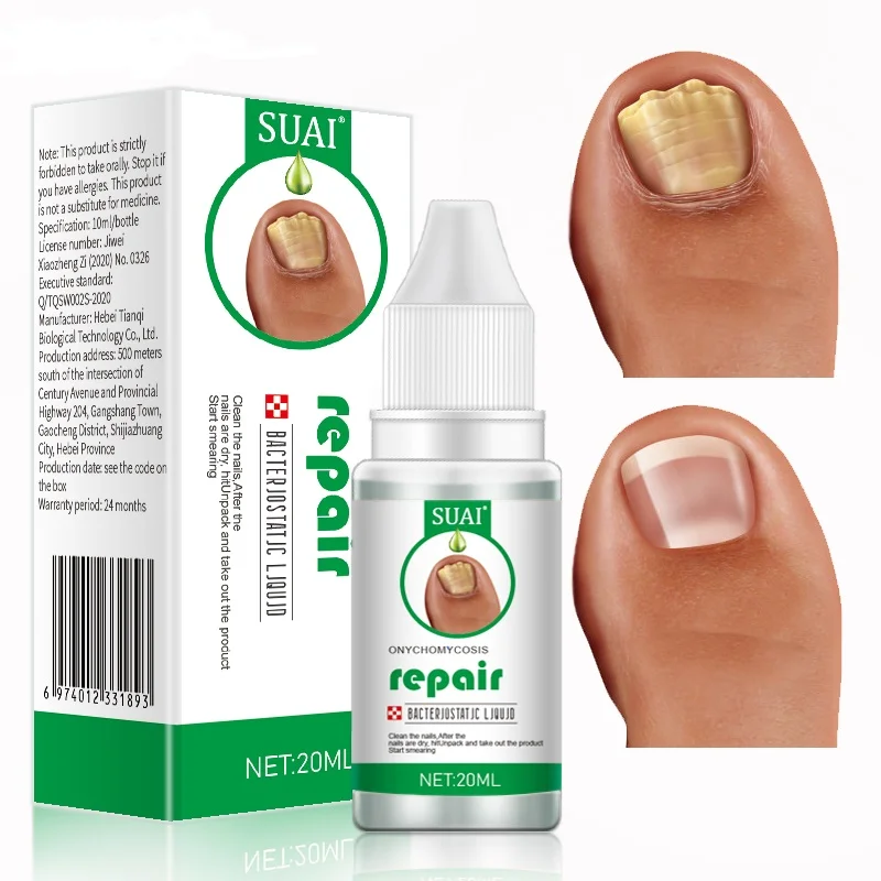 

Суай 20 мл лечение ногтевого грибка Уход за ногами Эссенция от грибков ногтей ремонт ногтей ног удаление геля против инфекции паронихия онихомикоси