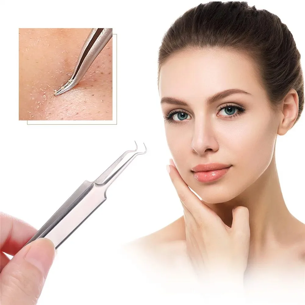 German Ultra-fine No. 5 Cell Pimples Blackhead Clip Tweezers Beauty Salon Special Scraping & Closing Artifact Acne Needle Tools precision tweezers tweezer tool pimples blackhead tweezers blackhead clip tweezers cosmetic tool