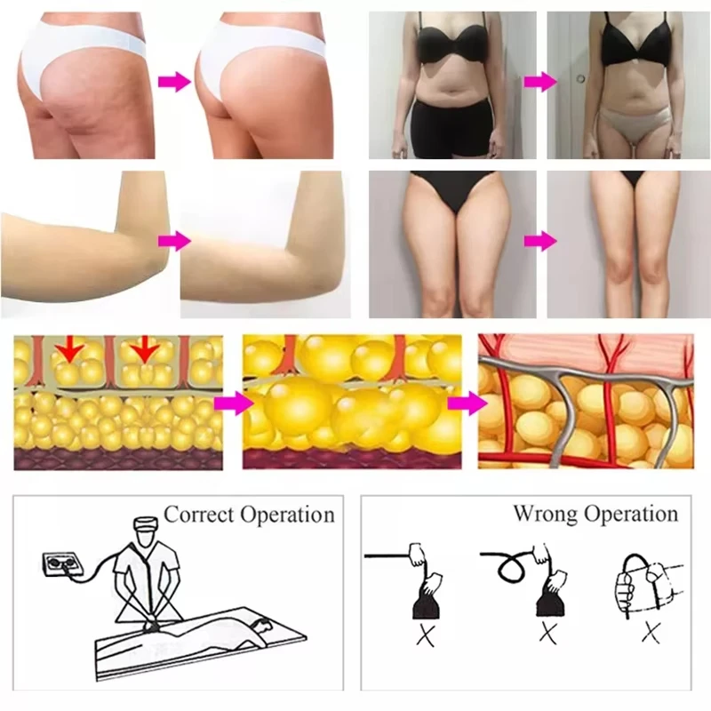 G5 Massage Cellulite Machine Portable High Frequency Fat Reduce Shaping Massager With 5 Heads