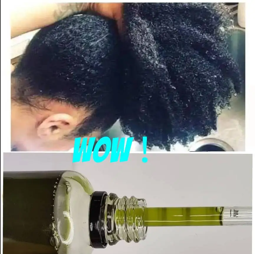 Best Hair Loss ReGrowth Serum Oil Treatment with Ginger Organic Oils Men and Women Hair Products