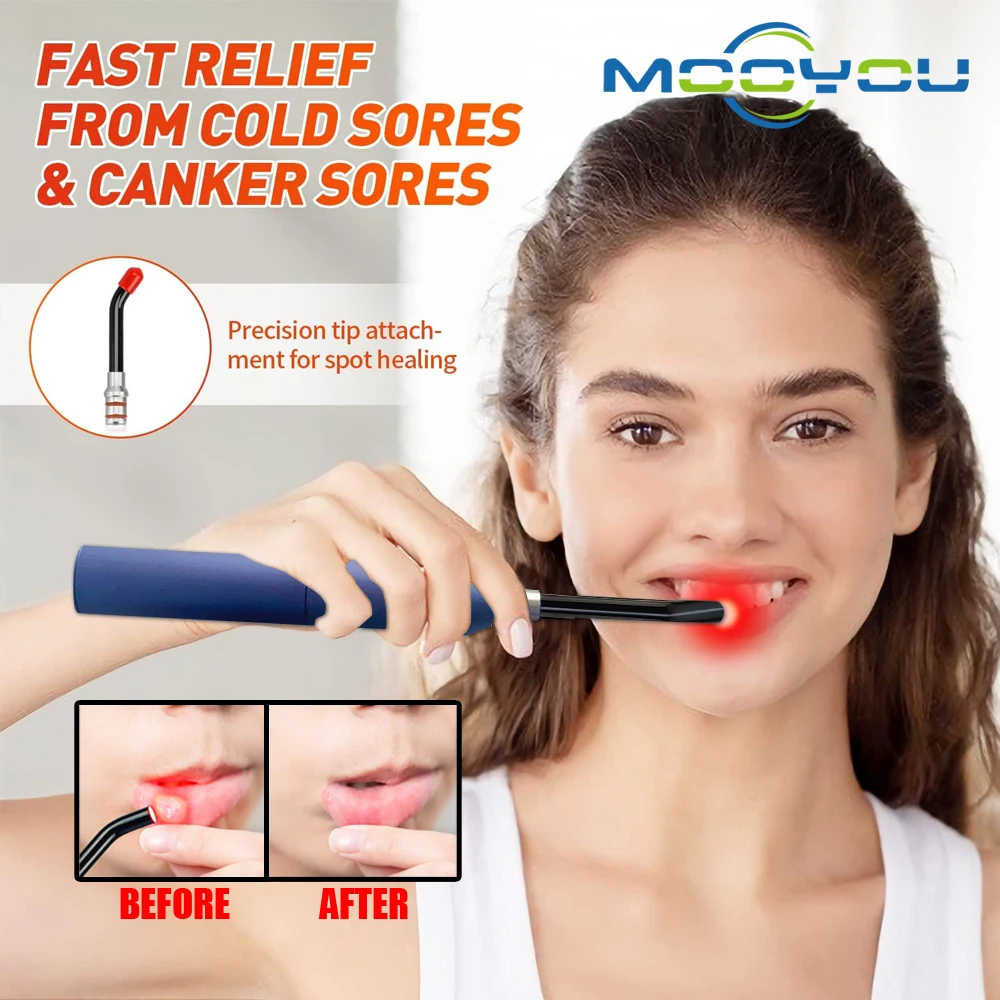 Mouth Ulcers Treatment Red Light Infrared Therapy Device Sore Canker Lip Therapy Handheld Oral Physiotherapy Wand Pain Relief handheld dv night vision device 8x digital zoom 4k camera full dark 600m scope infrared telescope for hunting camping nv2186