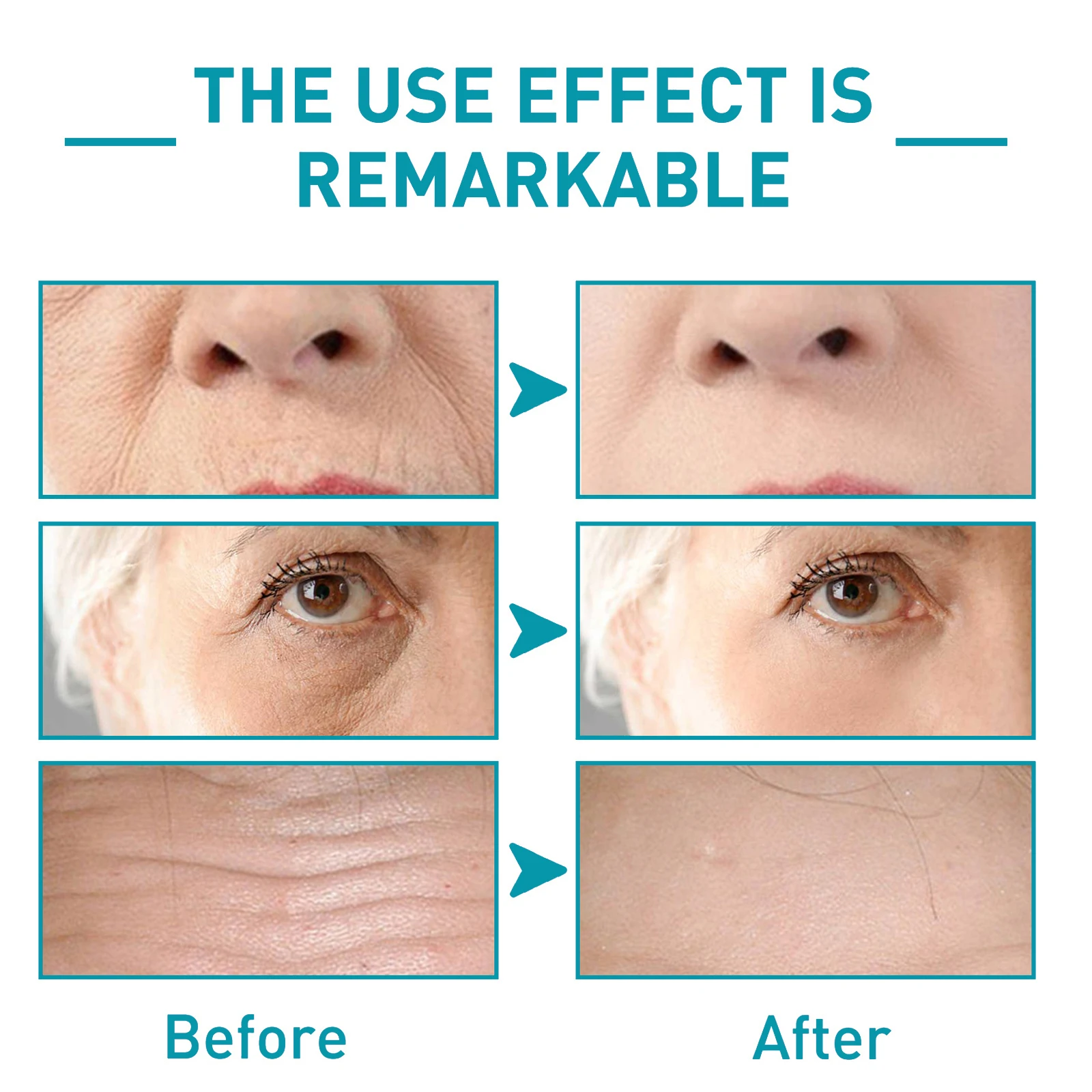Anti-Wrinkle Serum Skin Repairing & Lightening Crow's Feet Firming Serum with Convolvulus Peptide facial serum facial essence facial anti wrinkles product