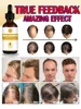 Óleos essenciais que promovem o rápido crescimento do cabelo e tratam a calvície e a queda de cabelo 3