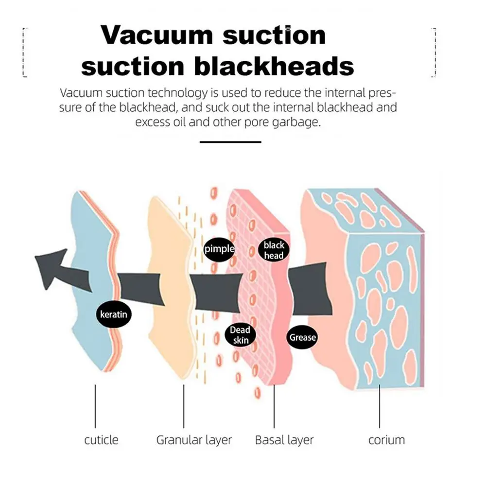 Pore Vacuum Cleaner Image 10