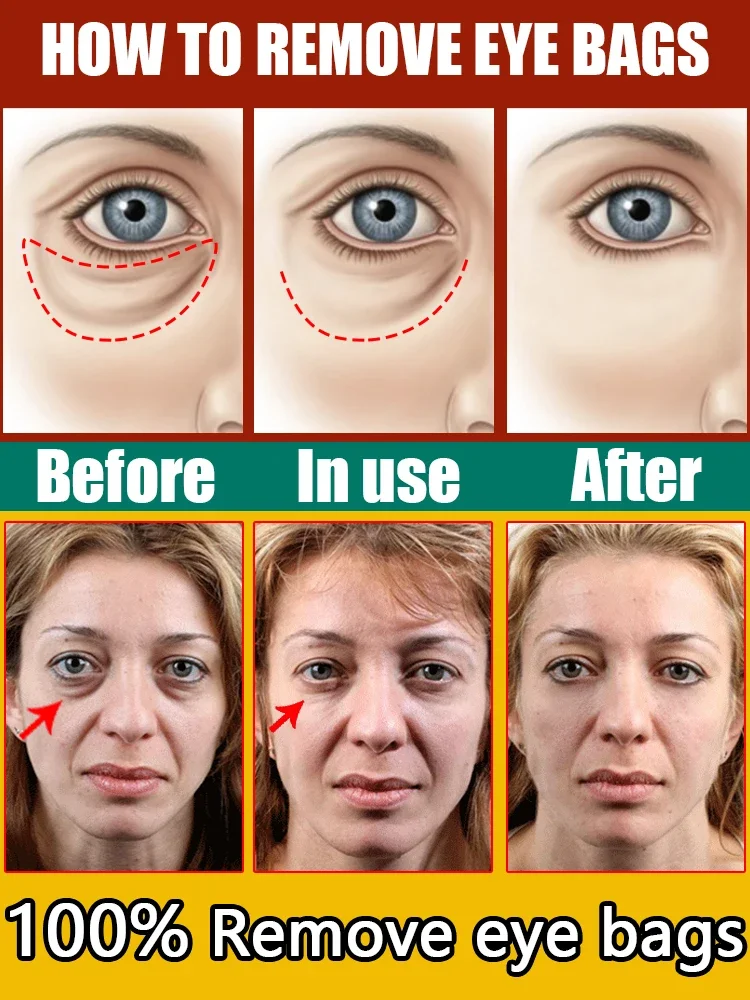 Anti Wrinkle Eye Cream Keep Your Eyes Forever Young anti wrinkle eye cream,eye cream