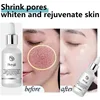 Remove Large Pores Serum Lactic Acid Facial Pore Shrinking Repairing Products Pore Minimizing Firming Smooth Korean Skin Care. 2
