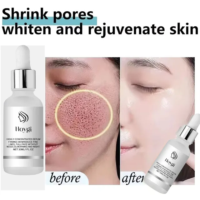 Remove Large Pores Serum Lactic Acid Facial Pore Shrinking Repairing Products Pore Minimizing Firming Smooth Korean Skin Care. 2