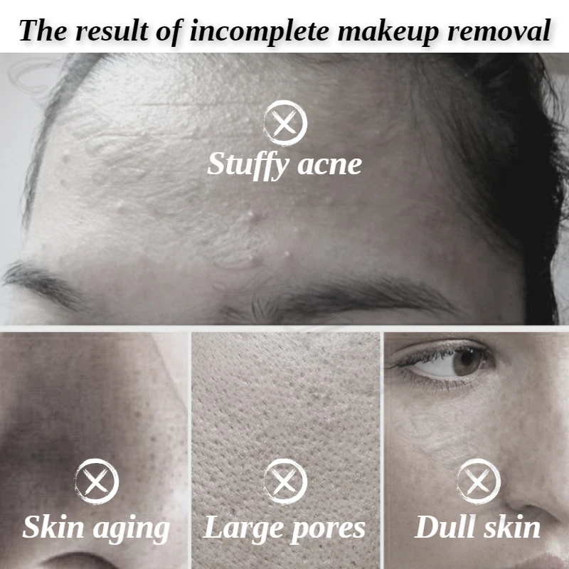 SKIN1004 Centella asiais cleansing oil deep cleansing blackhead pores refreshing not stuffy acne 200ml 4