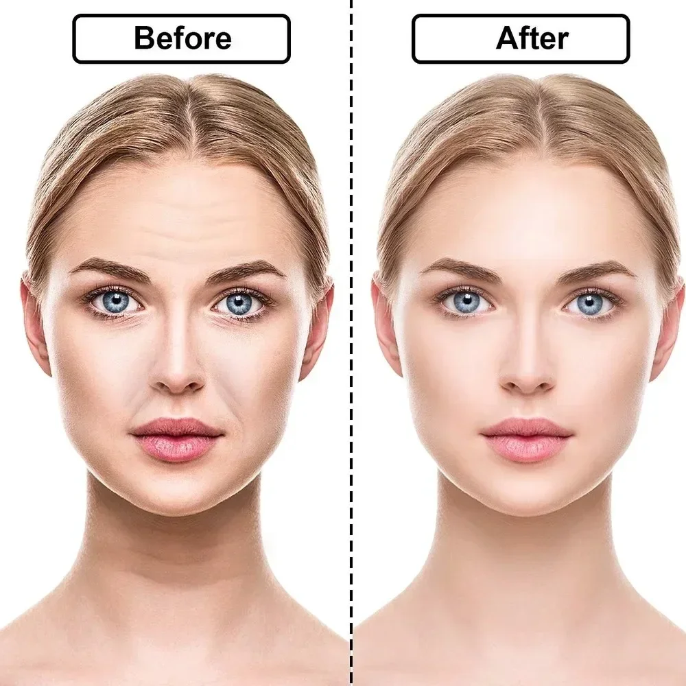 Reusable Silicone Wrinkle Removal Sticker Anti Wrinkle Pads Anti Aging Skin Face Lifting Patches Face Forehead Neck Eye Stickers 4