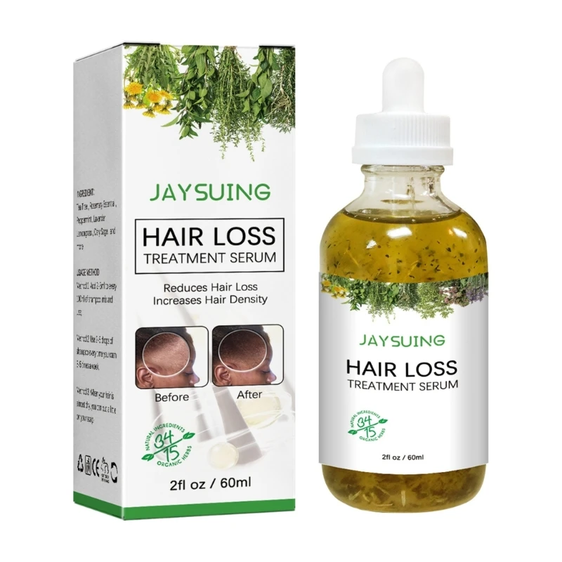 Hair Growth Products Essence Regrowth Oil for Men Hair Loss Care Scalp-Treatment