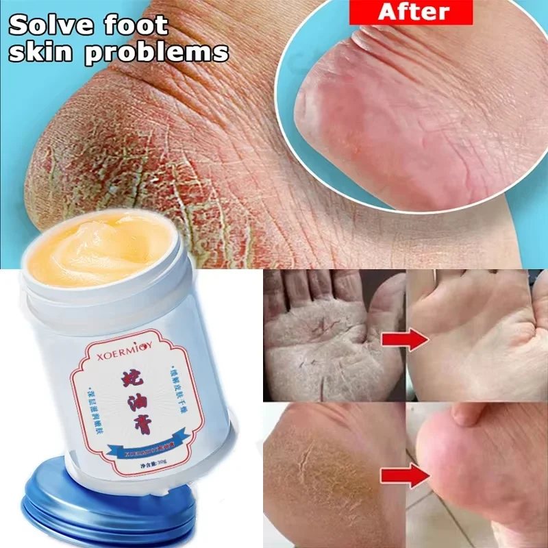 Foot cream Herbal Anti Crack Foot Cream Heel Crack Repair Products Exfoliating Dead Skin Removal Softening Moisturising Skin Care Men Woman