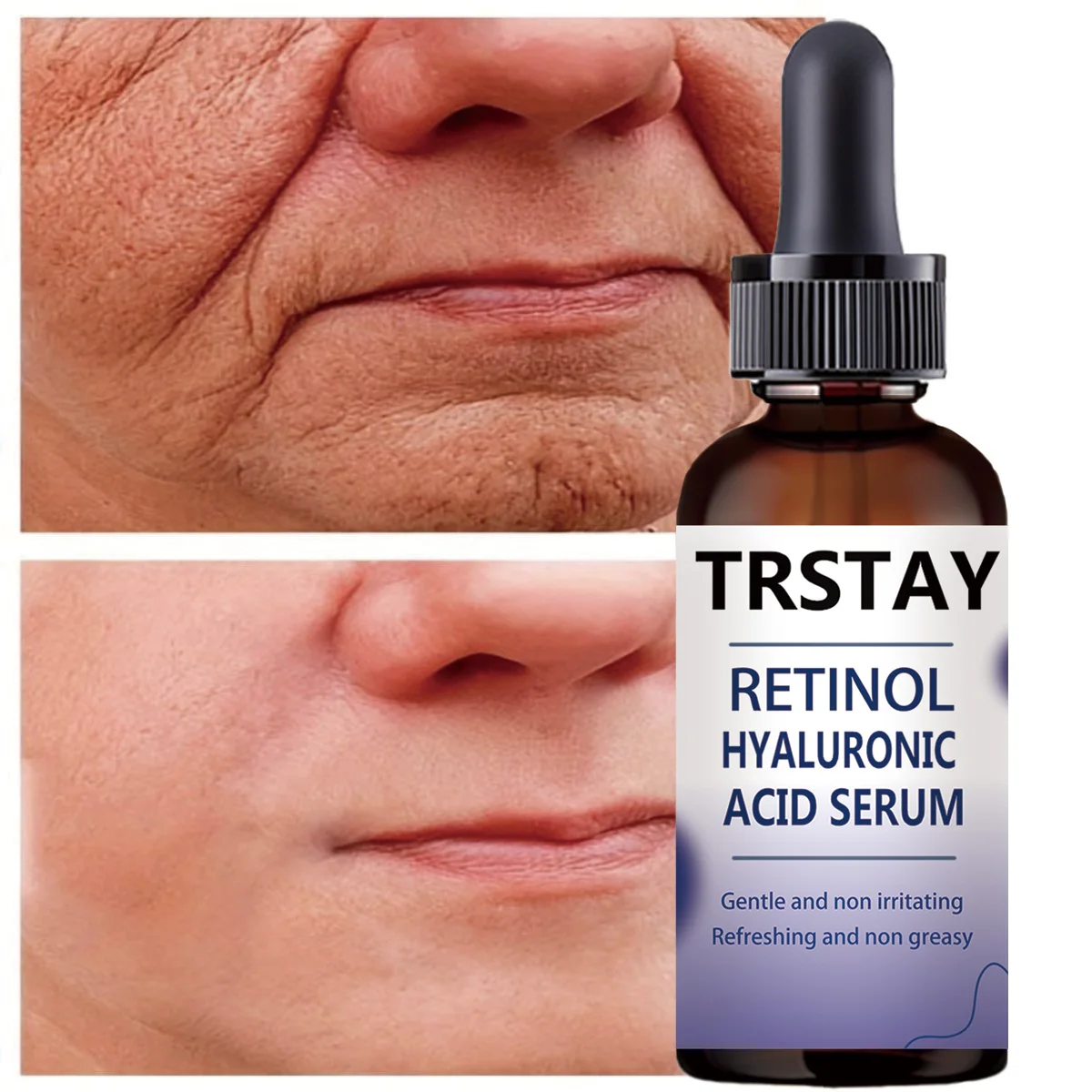 Facial Serum Retinol Hyaluronic Acid Gentle Non-Irritating Refreshing Non-Greasy Helps Improve Skin Condition