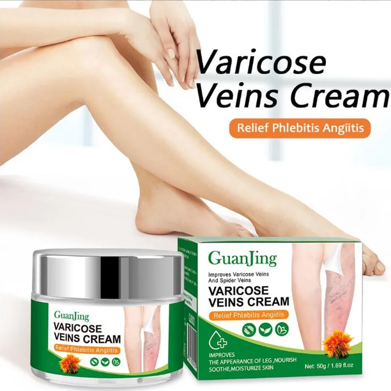 Varicose Veins Ointment Vasculitis Phlebitis Leg Spider Herbal