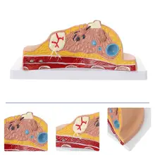 

Female Breast Disease Pathology Model Udder Lesion Model Patient Communication