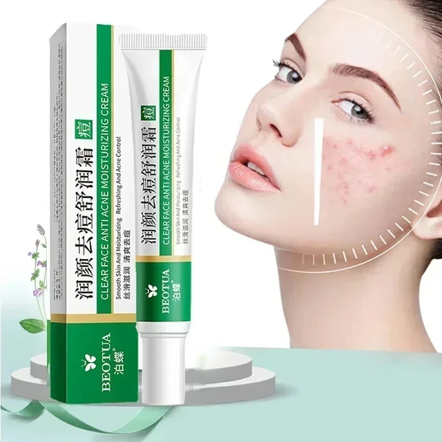 Korean Acne Repair Cream 1