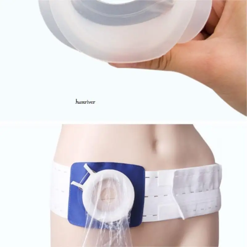 Anus Rectal Diversion Stool Fistula Bag Disposable Anal Bag Fecal Anorectal Leakage Poche A Urine Protable