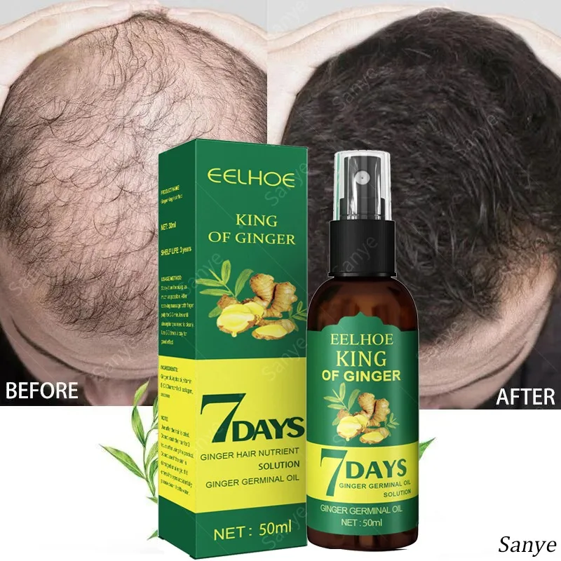 Women Ginger Fast Hair Growth Spray High Hairline Anti Alopecia Serum Bald Head Men Quickly Increase Head Hair Essential Oil 30ml anti alopecia fast hair growth oil ginger essential serum hairless baldhead increase high hairline head hair essence cream