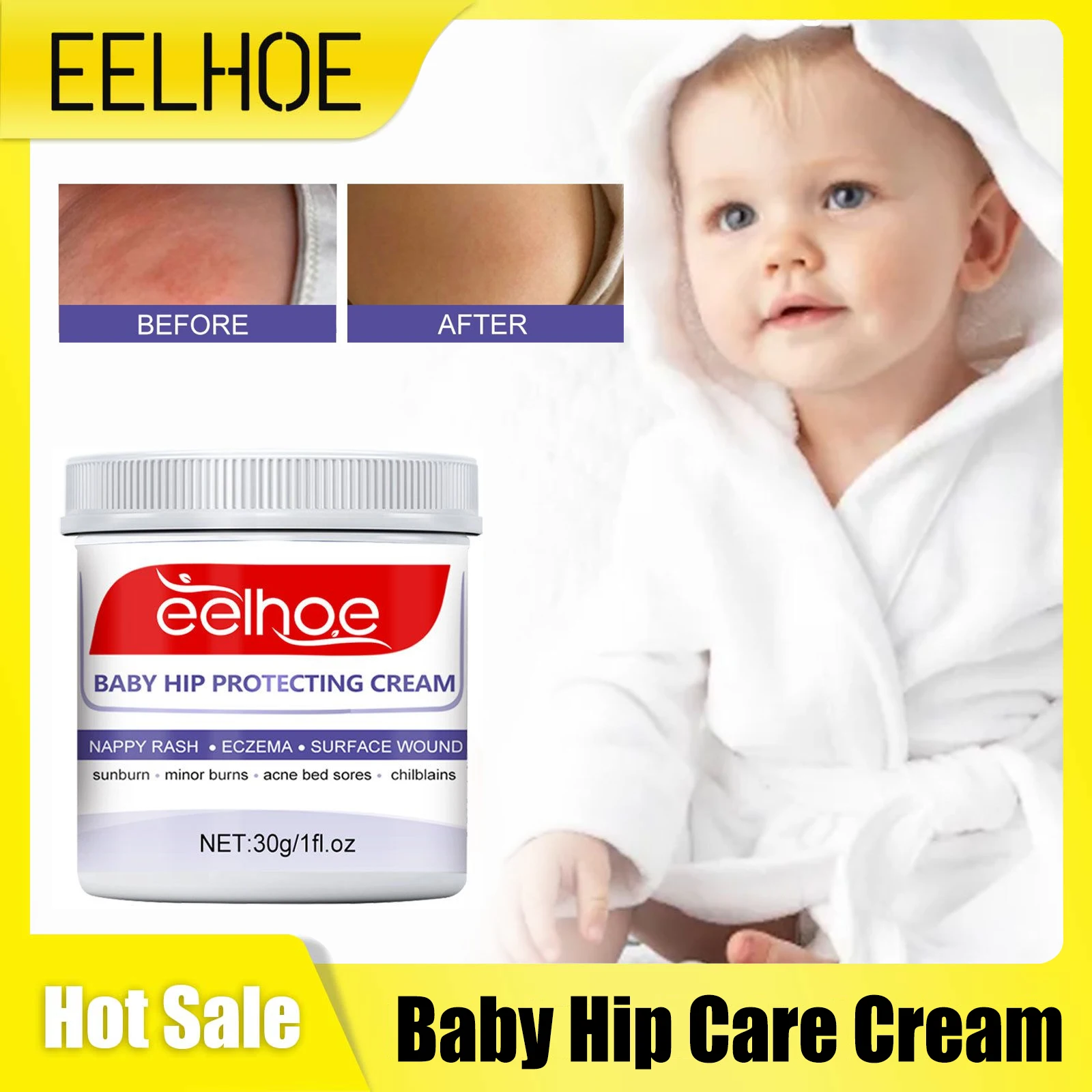 

Baby Hip Care Cream Repair Redness Anti Itching Nappy Rash Eczema Acne Bed Sores Soothing Hydrating Children Moisturizing Cream