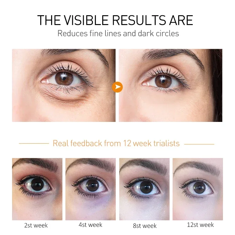 Anti Wrinkle Eye Cream Eye Cream Peptide Eye Bags Eye Cream Anti Dark Circle Hyaluronic Acid Wrinkle Removal Cream Roller Massager Skin Care Beauty