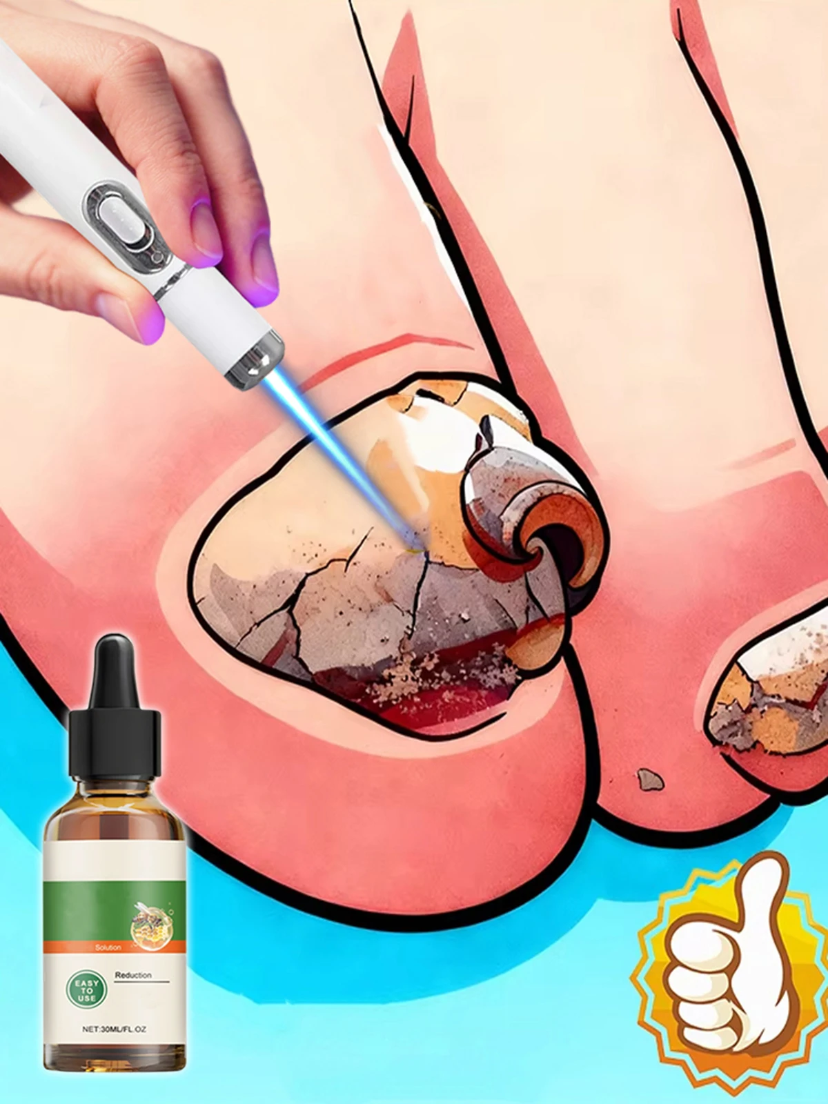 발 관리 레이저 펜 안전하고 부드러운 사용감 대다수에게 적합한 최고의 선택 일..