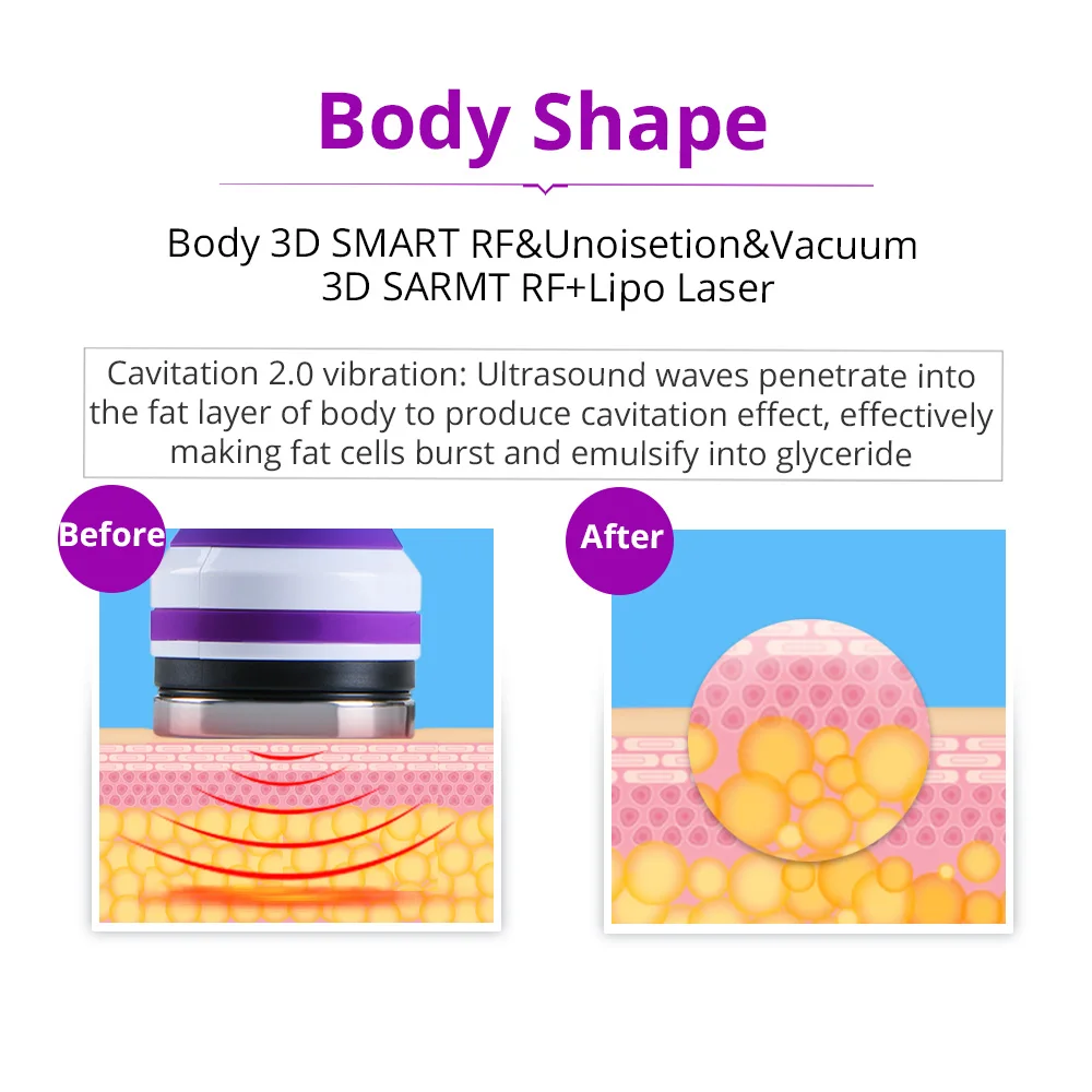 40K Cavitation RF Body Care Massager 3